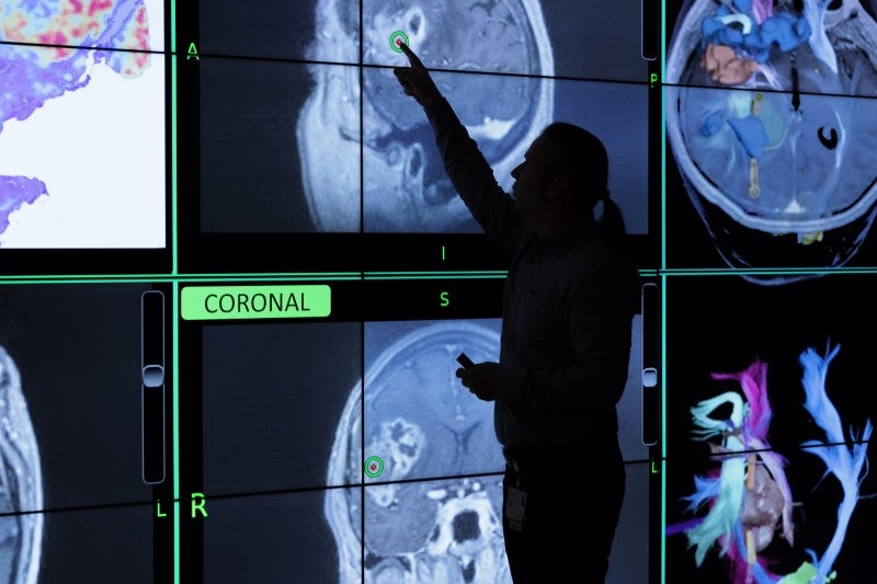 Leading Neuro-Oncologists Release Guidelines for Using AI in Brain Cancer Patients