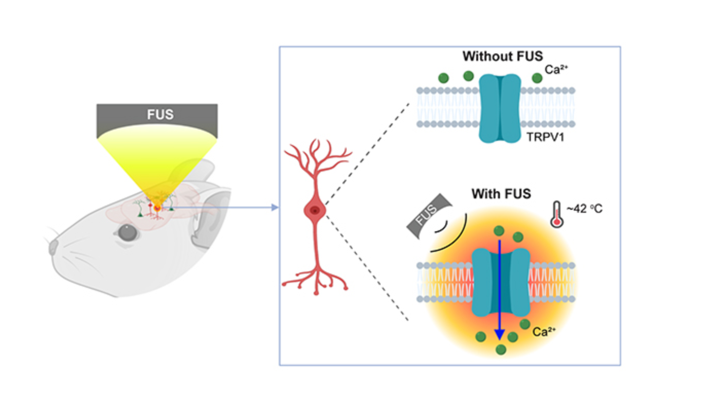 Stimulation Technique Uses Focused Ultrasound and Genetics to Activate Deep Brain Neurons