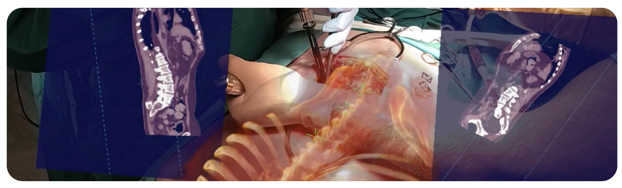 3D Augmented Reality Surgical Navigation System Gets FDA Approval for Spine Surgery