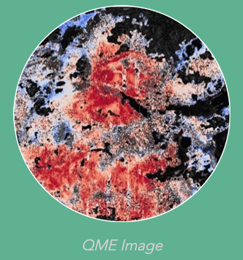 Quantitative Micro-Elastography Breast Cancer Imaging System Receives FDA Breakthrough Device Status
