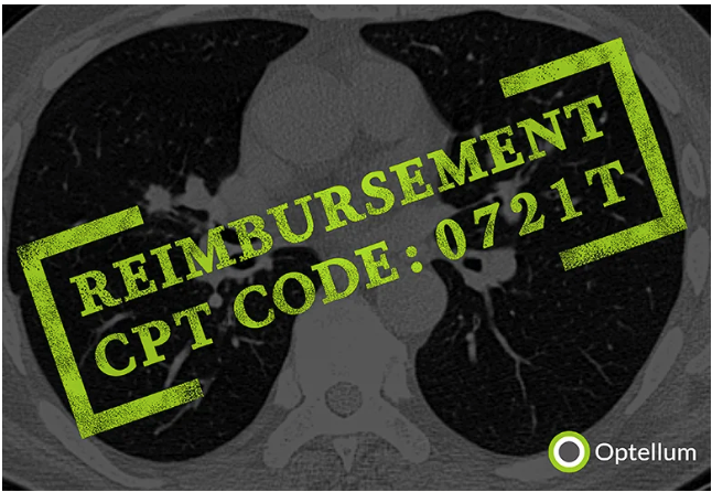 Optellum Lung Cancer Prediction Technology Gets CMS Payment Classification