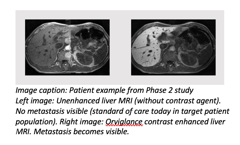 Study Indicates Oral MR Imaging Agent Well Tolerated with Food