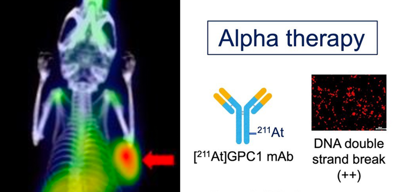 Theranostics Study Targets Glypican-1 in Pancreatic Ductal Adenocarcinoma