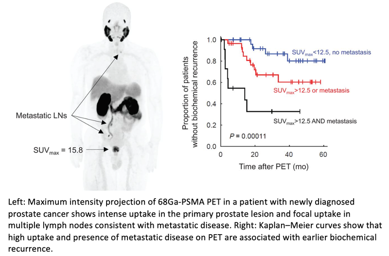 PSMA PET/MRI Accurately Predicts Prostate Cancer Recurrence Risk