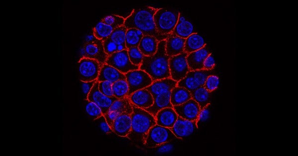Researchers Identify Mechanism Behind Hyperprogression After Immunotherapy