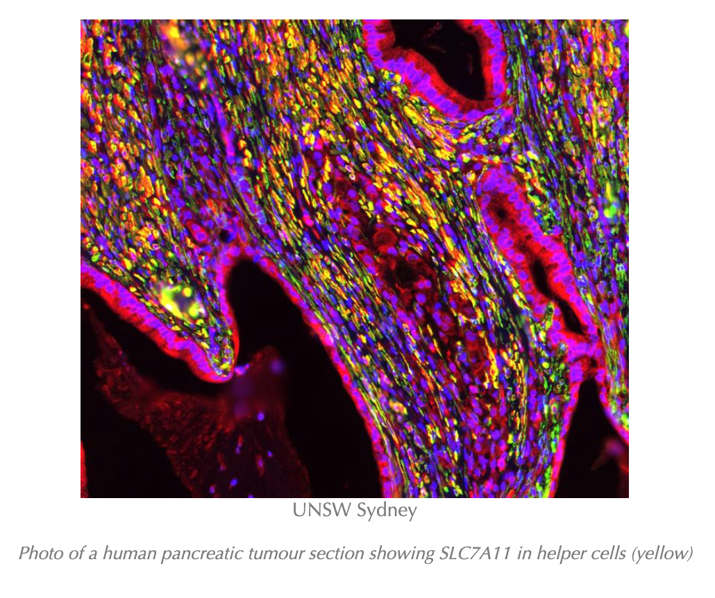 Scientists Show How to Attack The “Fortress” Surrounding Pancreatic Cancer Tumors