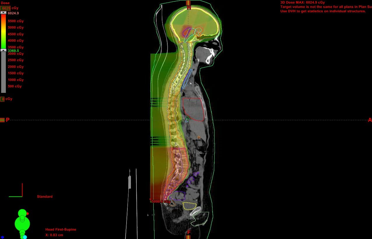 Pediatric proton therapy: Payments, call for studies, and benefits for brain cancer