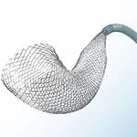 Medtronic Recalls Pipeline Flex Embolization Devices