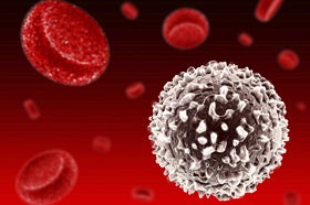 PSMA PET Imaging Enhances Detection of Bone Metastases in Prostate Cancer Patients