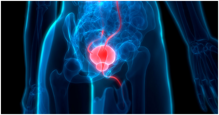 FDA Grants Fast-Track Designation for mCRPC Theranostics