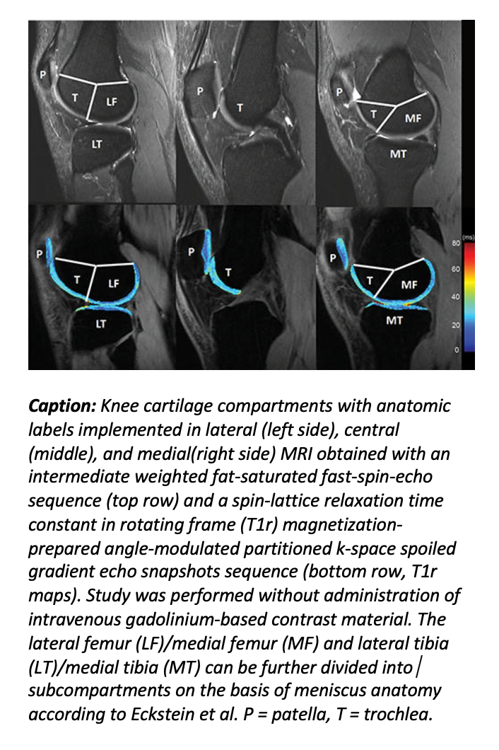 New QIBA Profile for MRI-based Measurements of Knee Cartilage Degeneration