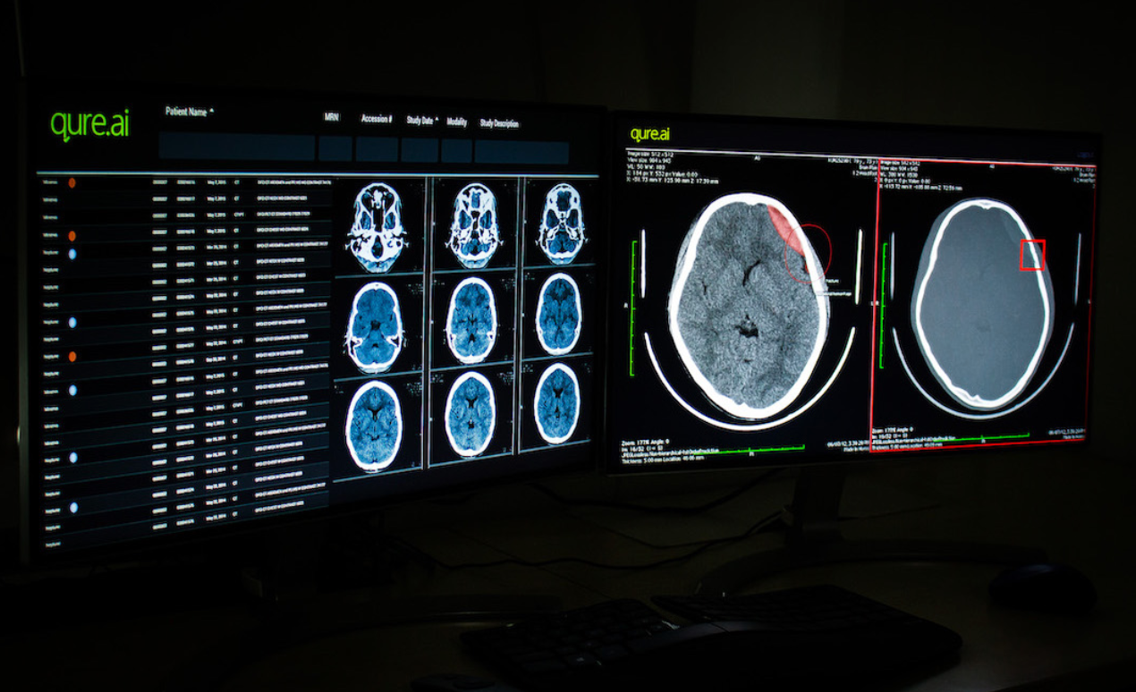 Qure.ai Nets Second FDA Clearance for Brain CT Scan AI