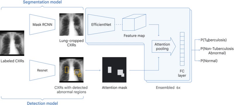 AI-Based System Comparable to Radiologists in Tuberculosis Detection