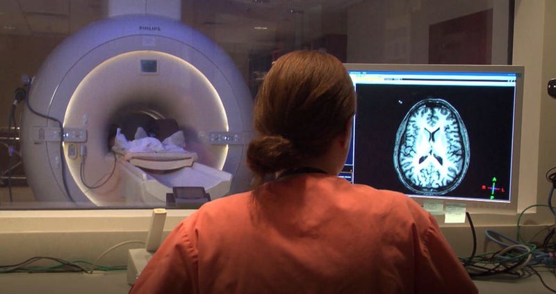 MRI Detects Significant Brain Abnormalities Post-COVID Infection