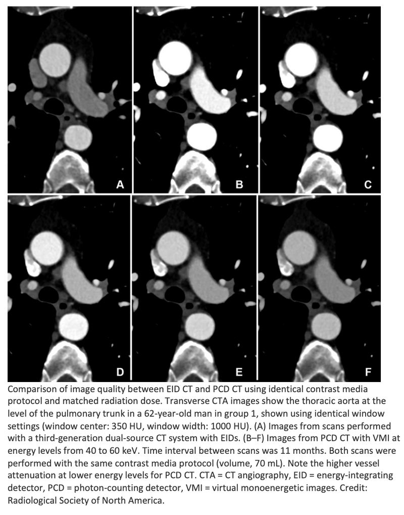 Lower Contrast Media Use With Photon-Counting CT of the Aorta