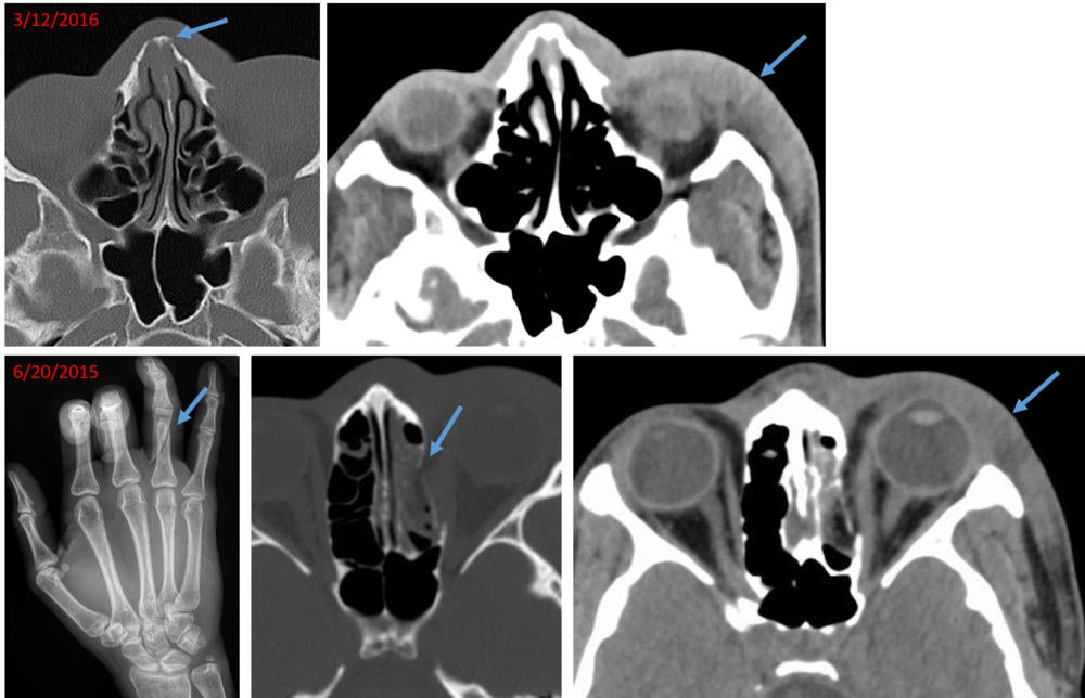 RSNA 2017: Diagnostic images can help identify sexual assault and domestic abuse