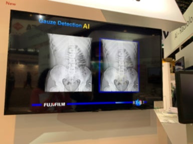 FUJIFILM showcases AI for digital radiography
