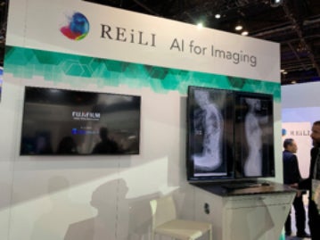 FUJIFILM showcases AI for digital radiography