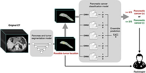 Deep-Learning Tools Detect Pancreatic Cancer on CT