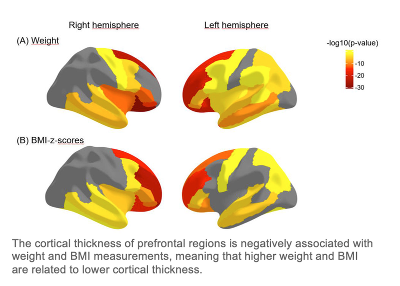 Obesity Linked to Poor Brain Health in Children