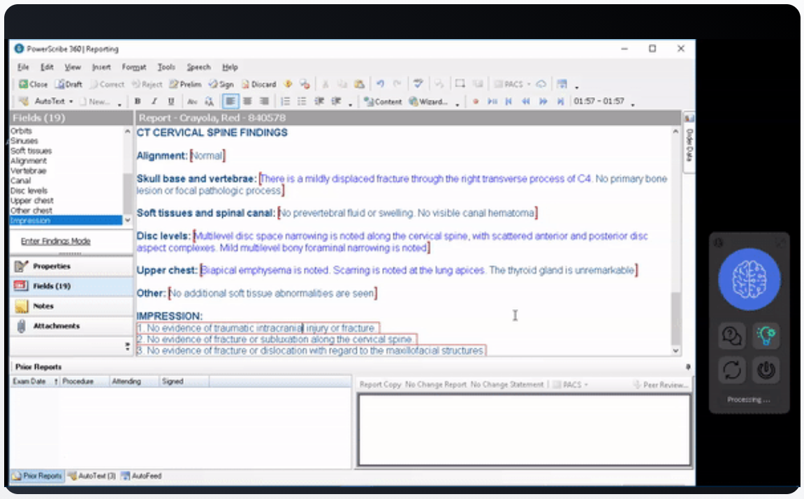 Partnership Brings AI Technology for Customized Radiology Reports to Radiology Group