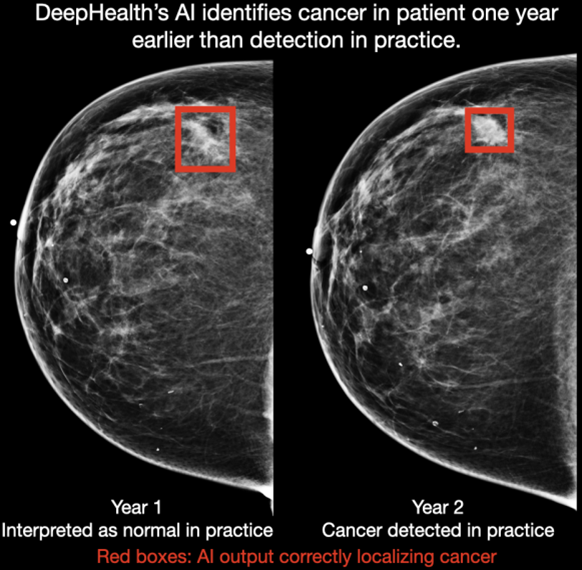 Radiology Imaging Associates Launches AI-Powered Enhanced Breast Cancer Detection Program