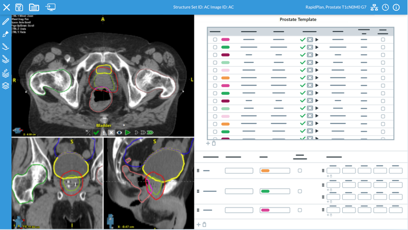 Radformation Acquires Limbus AI