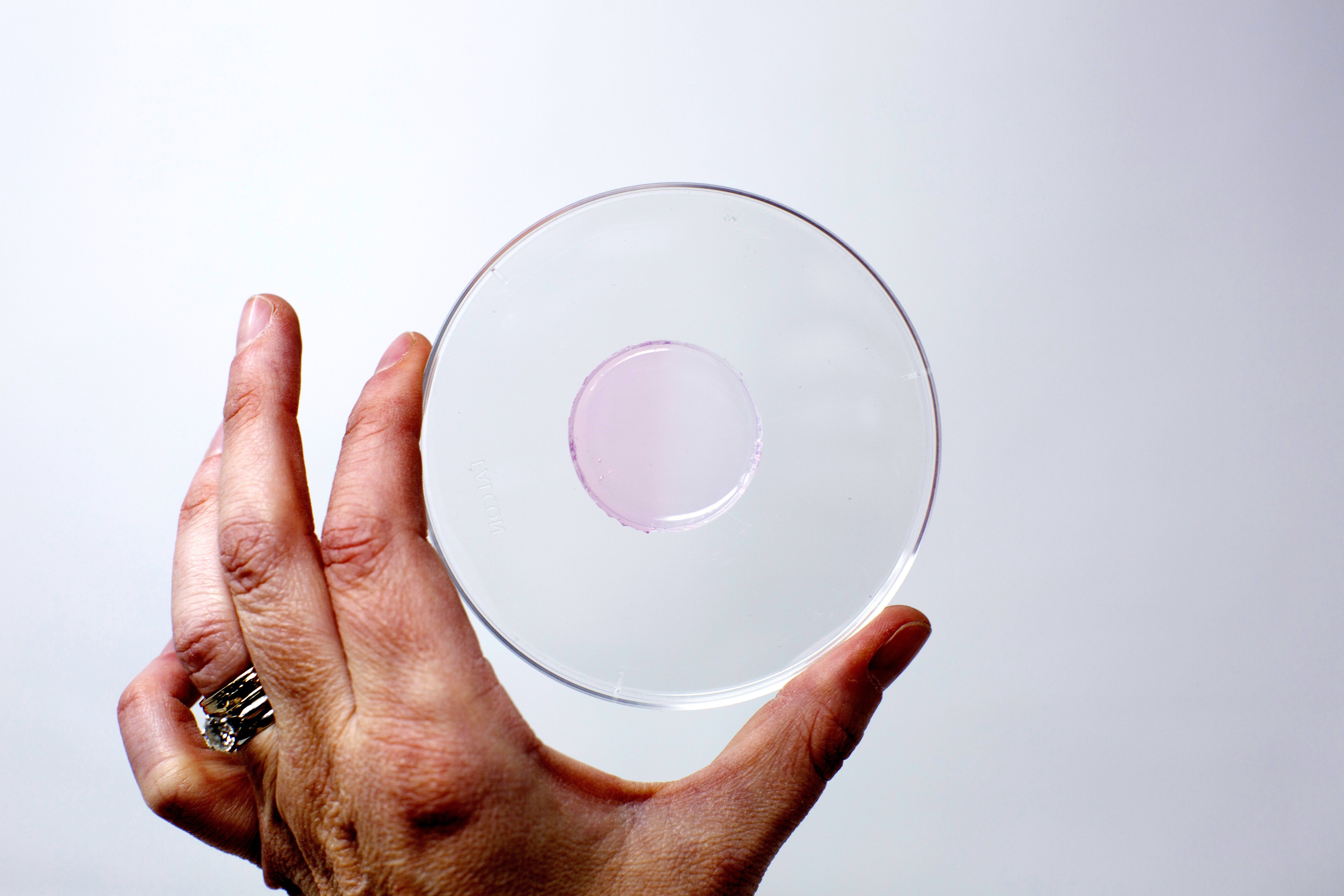New gel-based nanosensor can monitor cancer radiation therapy doses