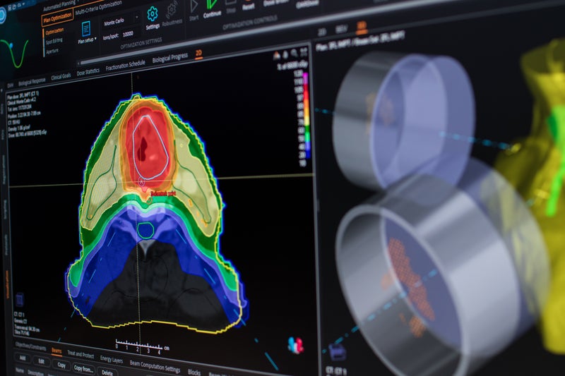 RaySearch Launches RayStation 2024A