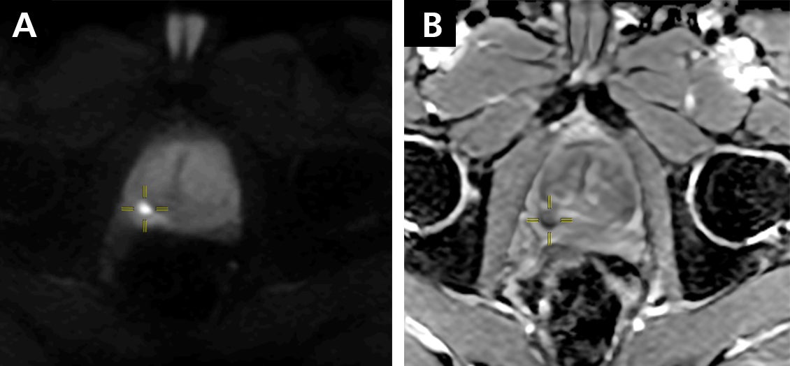 SDMI Sizes Up: New Canon 3T Supreme MRI Delivers Quality, Comfort, and Convenience