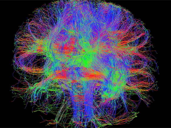 Researchers Develop Method to Map Individual Brain Dynamics Using Imaging Data