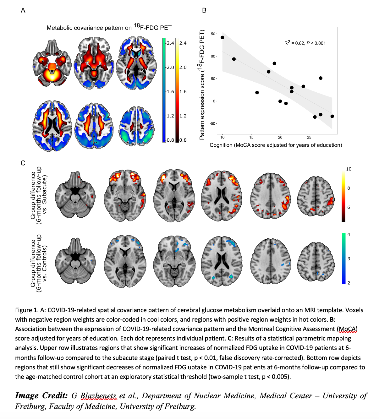 SNMMI ’21: Image of the Year Goes to PET Imaging Measuring Cognitive Impairment in COVID-19 Patients