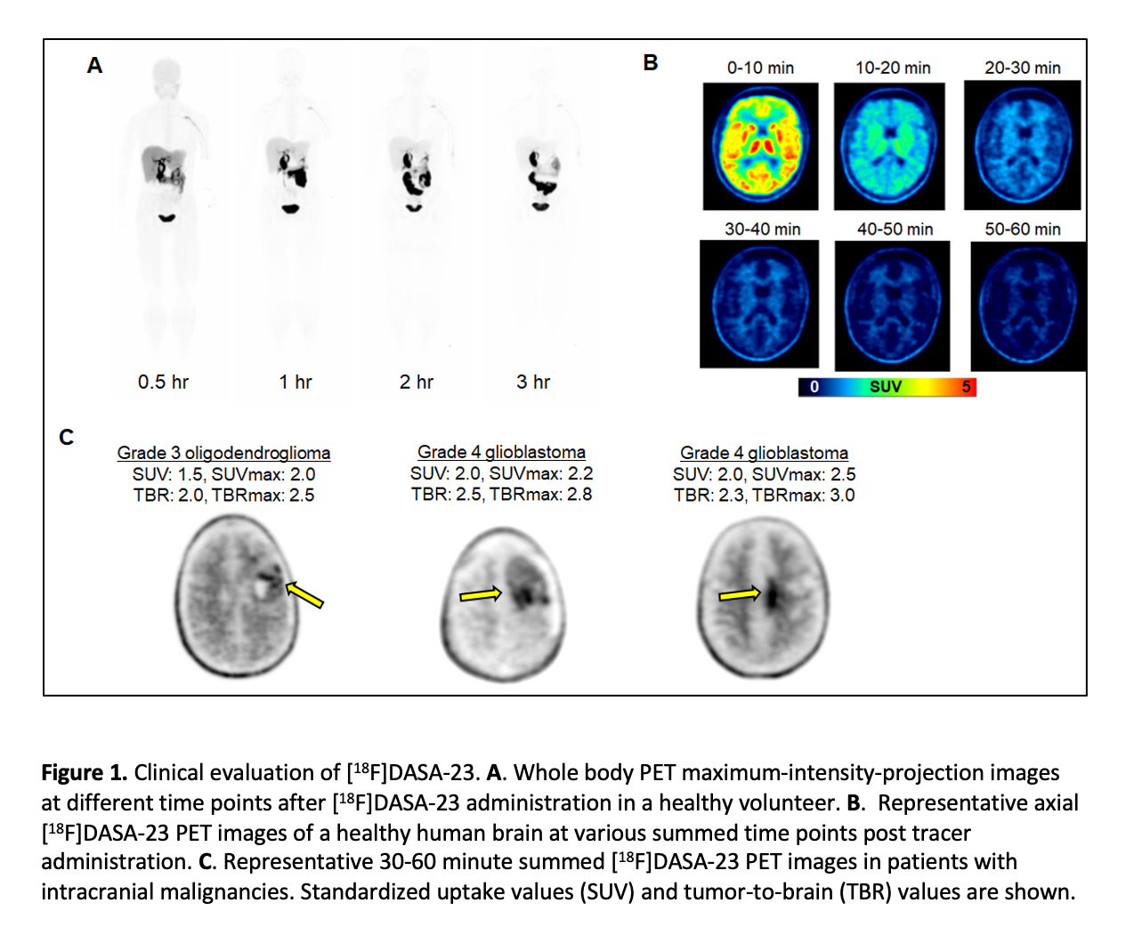SNMMI ’21: Novel Radiopharmaceutical Tracks Protein Responsible for Cancer Growth