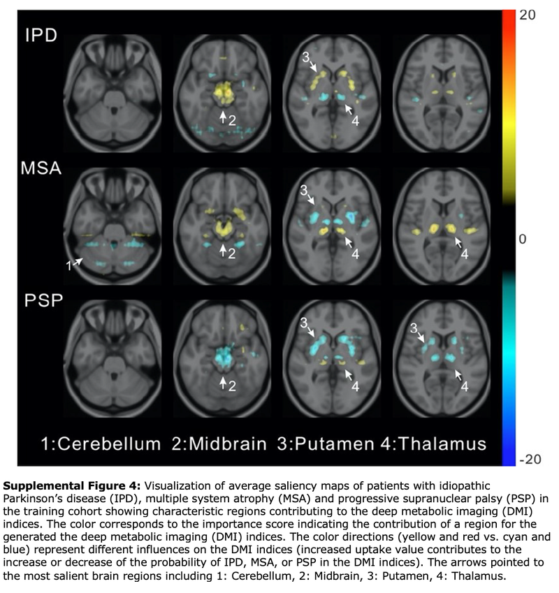 Deep-Learning Method Aids in Diagnosing Parkinsonian Diseases