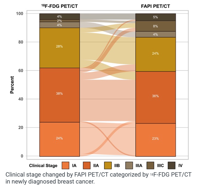 FAPI PET/CT Improves Staging of Newly Diagnosed Breast Cancer Compared to FDG