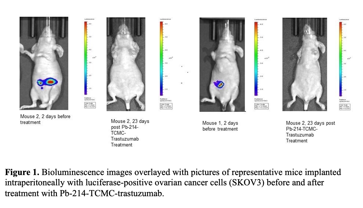 SNMMI ’21: Preclinical Trials Show Promise for Ovarian Cancer Radiopharmaceutical Treatment