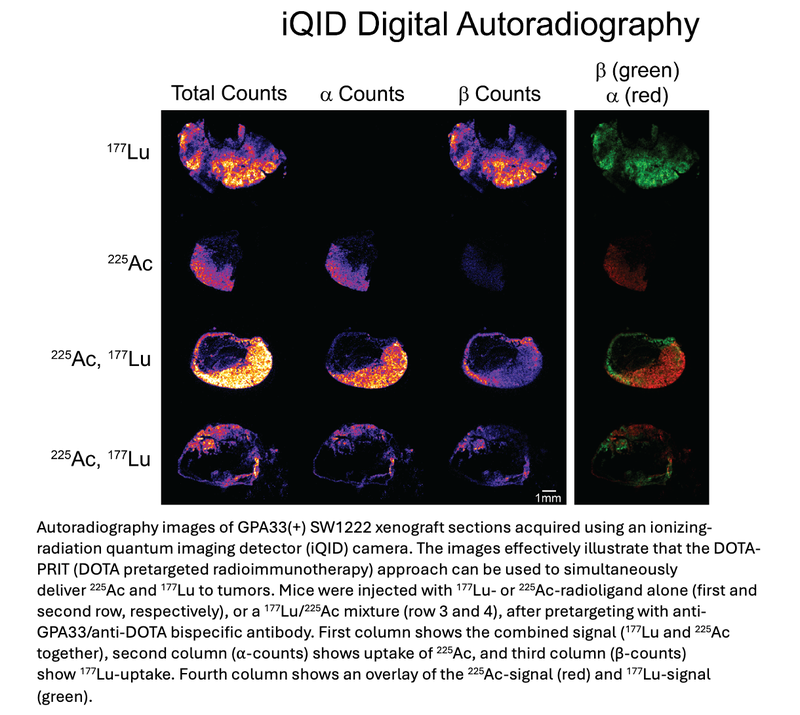 Dual-Isotope Radionuclide Therapy Safe, Effective in Colorectal Cancer