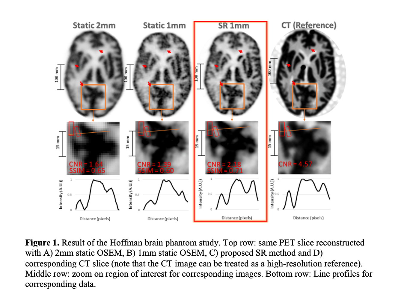 SNMMI '21: Super-resolution PET with Motion Tracking Enables More Detailed Brain Imaging