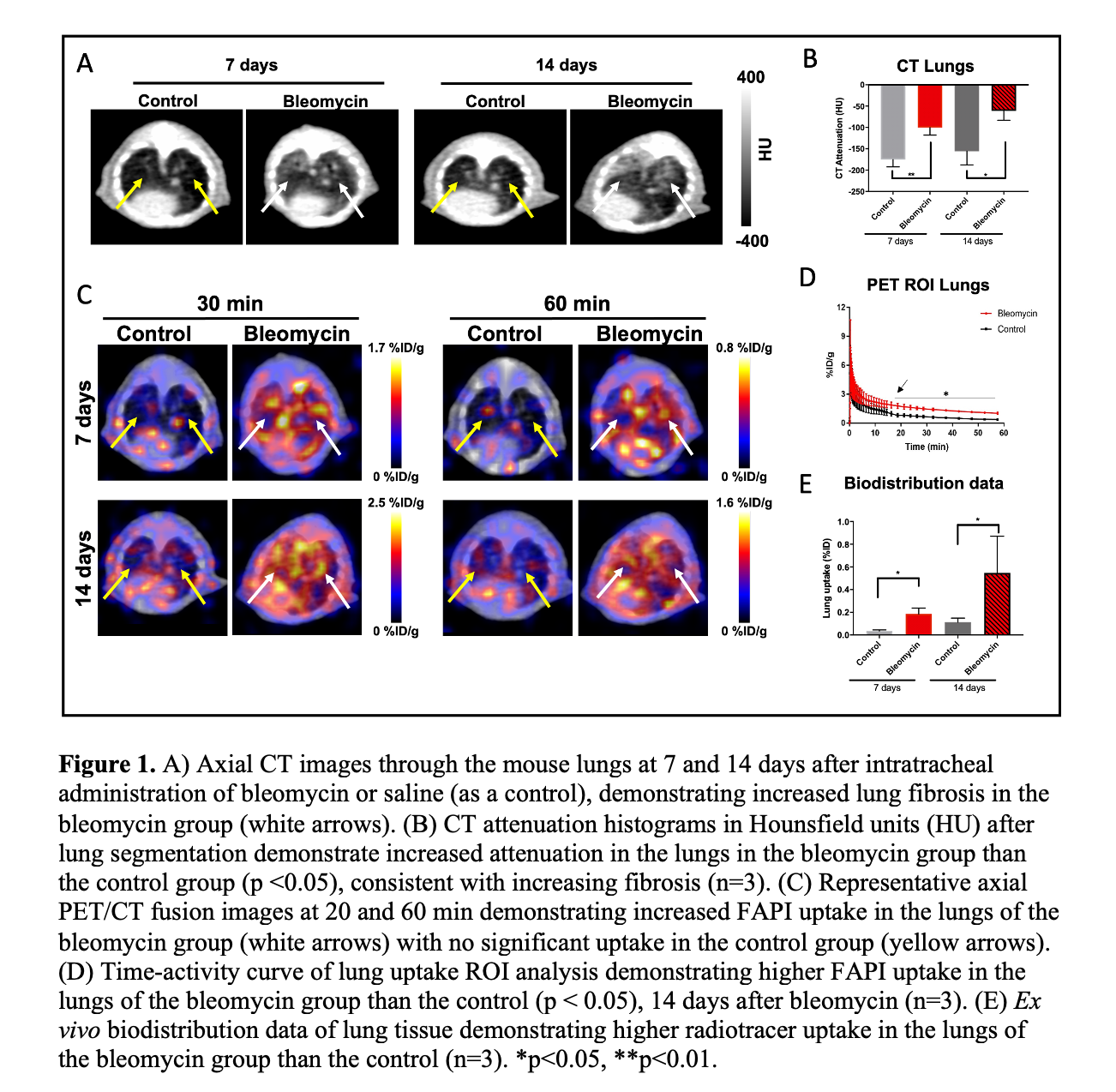 SNMMI ’21: 68Ga-FAPI-PET Non-invasively Detects, Assesses Pulmonary Fibrosis