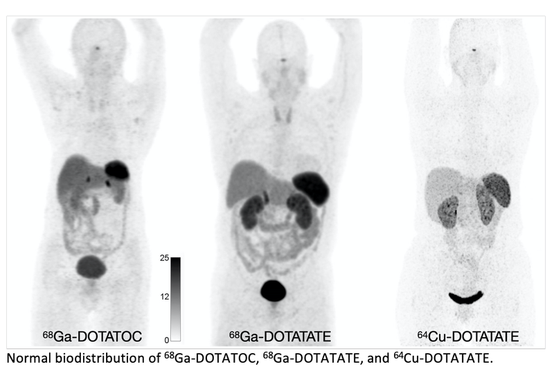 Procedure Standard/Practice Guideline Published for Neuroendocrine Tumor PET Imaging