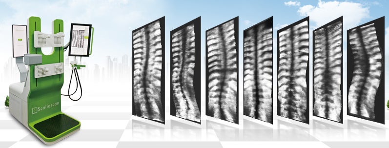Evaluating a 3D ultrasound imaging scoliosis assessment system