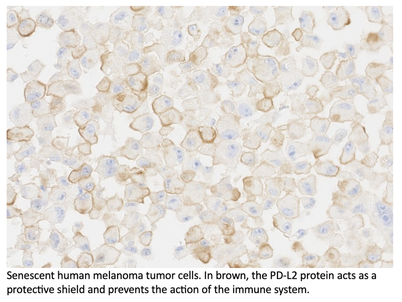 Chemotherapy More Efficient After Immunotherapy Eliminates Senescent Cells