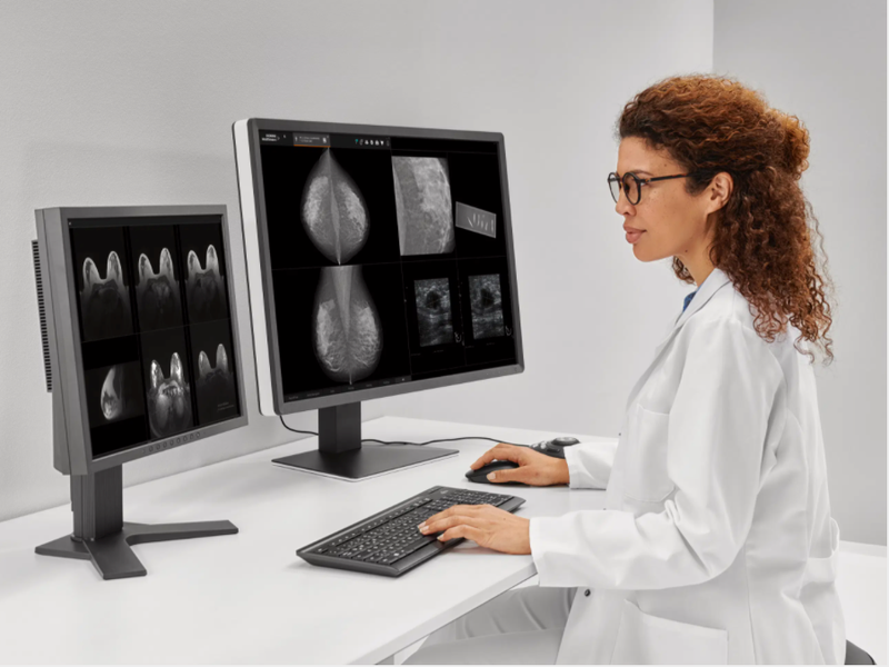 FDA clears Siemens Healthineers’ Mammography Smart Reading and Workflow Solutions