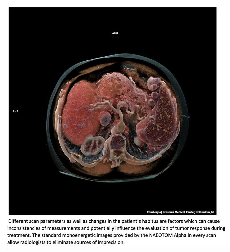 Siemens Launches World’s First Photon-Counting CT Scanner