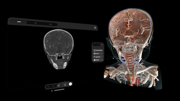 Siemens Healthineers to Launch Cinematic Reality App at HIMSS 2024