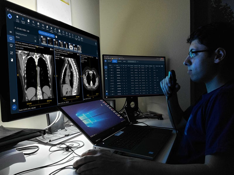 New Partnership Supports Diagnosis of Lung Cancer