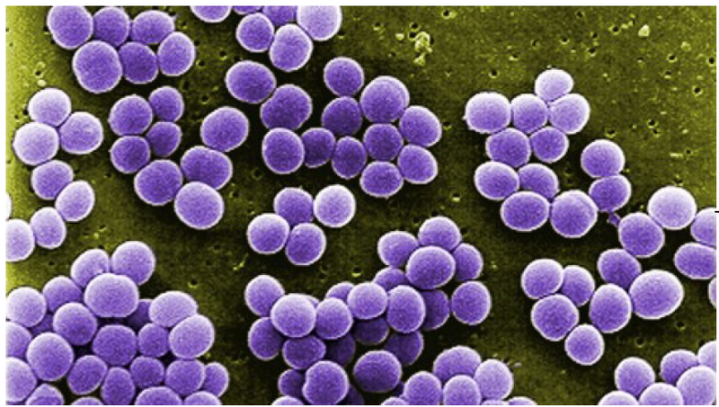 PET Scans Guide Treatment for Orthopedic Implant Bacterial Infections