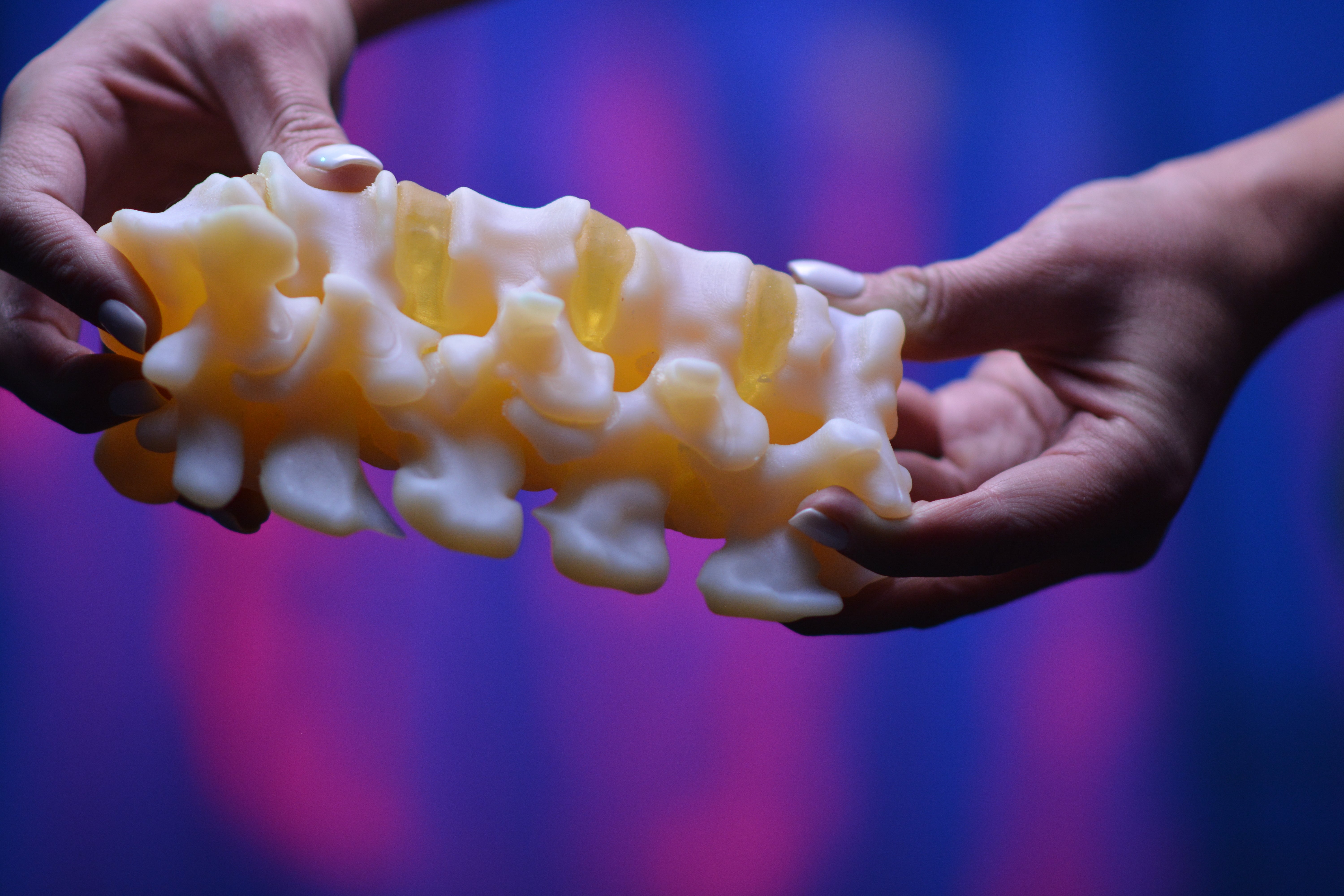 New Partnership Delivers Point-of-Care Anatomic Modeling Solution