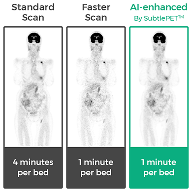 Subtle Medical receives CE Mark approval and FDA clearance for SubtlePET™