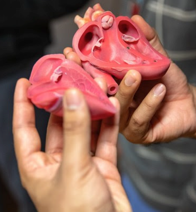 Tampa General, USF Health Team up on 3D Printing Program to Guide Surgery